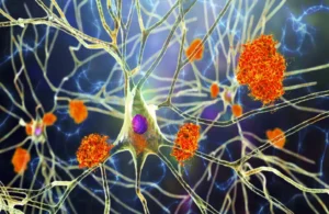 “النبات المعجزة”.. مفتاح جديد لعلاج ألزهايمر